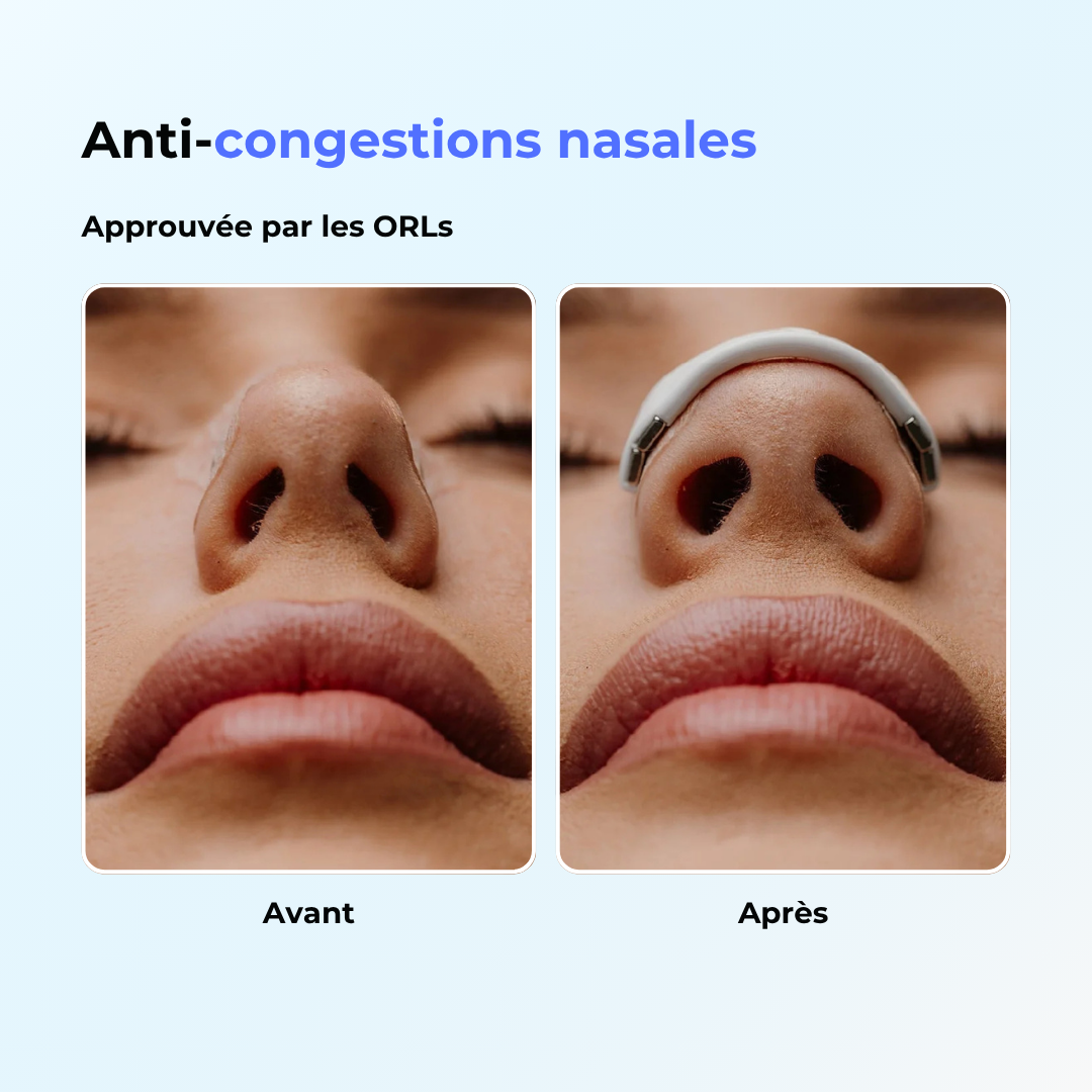 BonAir™ - Bande nasale magnétique